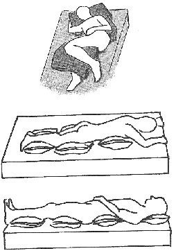 FIGURE 2.5. Positioning/Turning in Bed